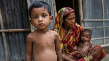দেশে পাঁচ বছরের কম বয়সী ২৪% শিশু খর্বকায়
